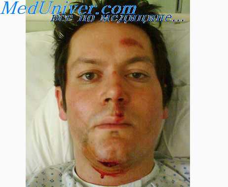 ортопедические аппараты