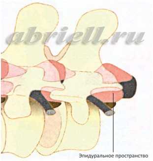 Оболочки спинного мозга в объёмном изображении