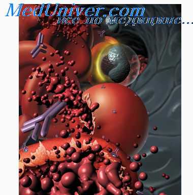 сосудистый гемолиз