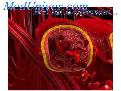 отек легких