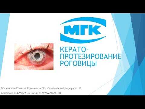 Видео Кератопротезирование роговицы