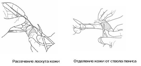 Последний этап