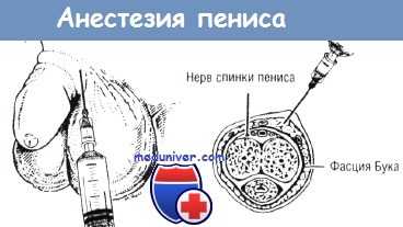 Методика анестезии пениса