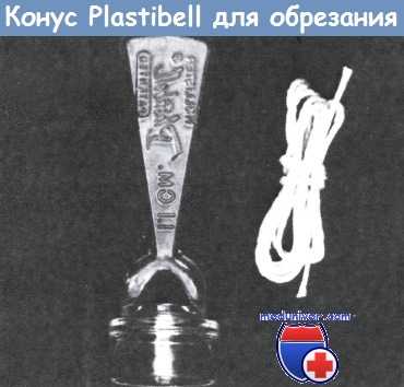 Конус Пластибелл для обрезания