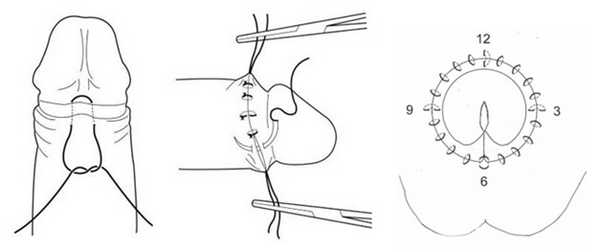 Косметический эффект