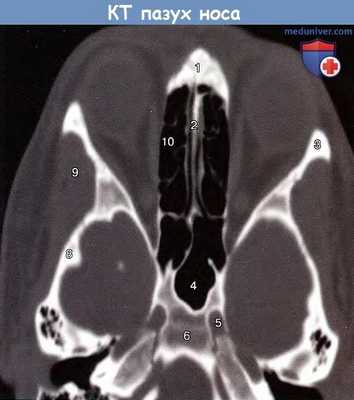 КТ пазух носа