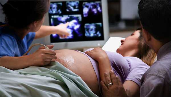 УЗИ при беременности