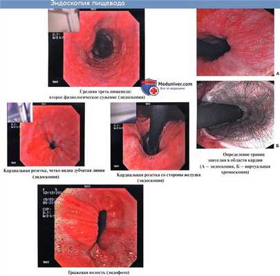 Анатомия : Пищевод. Строение пищевода. Мышцы пищевода. Кровоснабжение и иннервация пищевода. Рентгеноанатомия пищевода. Эндоскопия пищевода