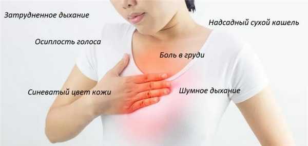 Тимома симптомы