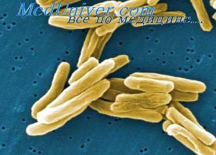 туберкулез