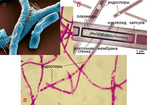 Бактерии сибирской язвы