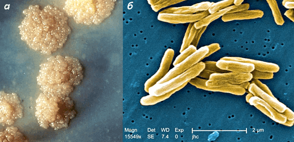 Микобактерии туберкулеза