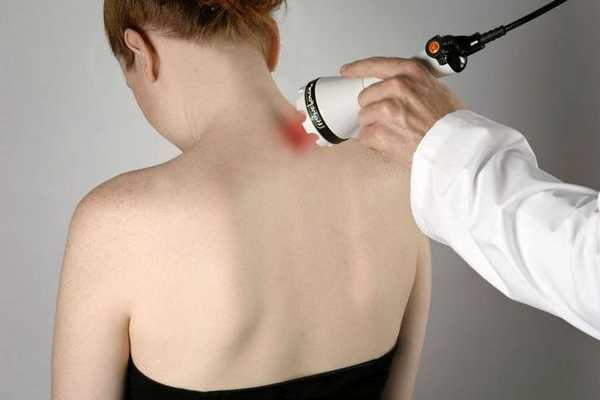 Магнитотерапия