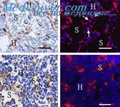 болезнь щитовидной железы