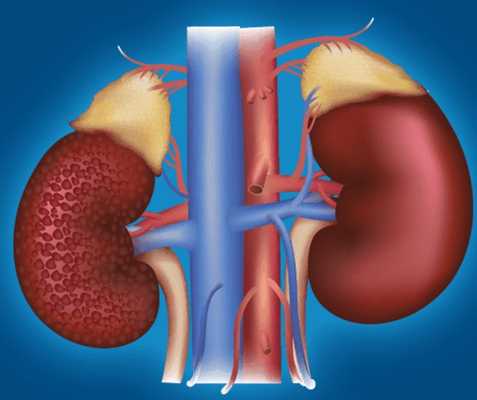 Острая почечная недостаточность