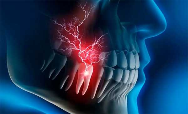 Острая зубная боль