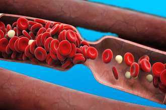 Образование сгустков
