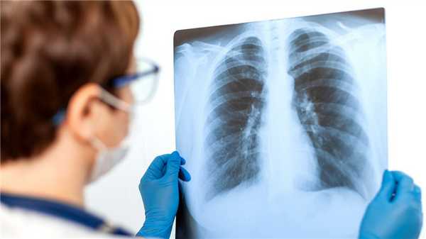 Двусторонняя пневмония