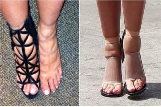 Отечность ног