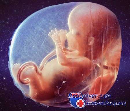 пренатальное кариотипирование