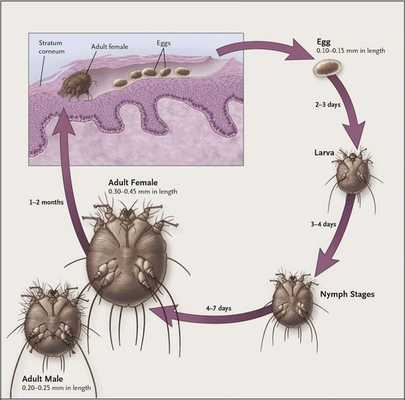Этапы развития чесоточного клеща под кожей