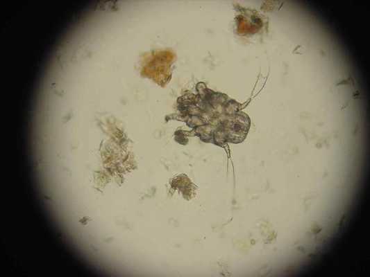 Чесоточный клещ под микроскопом