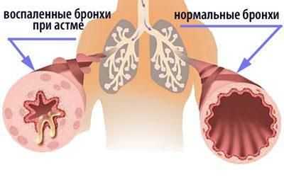 Развитие стмы