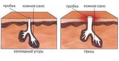 Возникновение сыпи