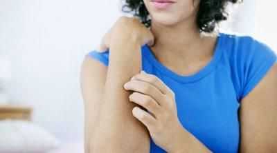 Крапивница