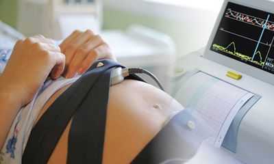 КТГ (кардиотокография)