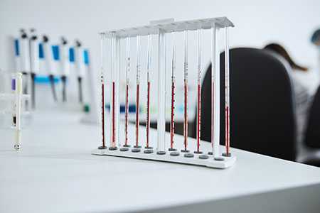 Анализ крови на хронический алкоголизм порядок сдачи, исследуемые маркеры - Клиника ЛОРДМЕД