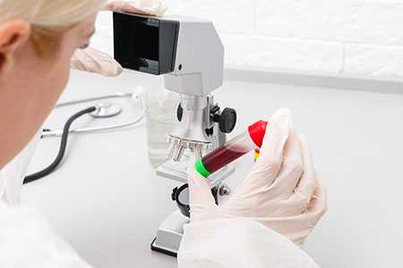 Средний объем эритроцита - Клиника ЛОРДМЕД