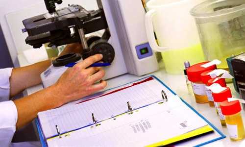 расшифровка анализа мочи 