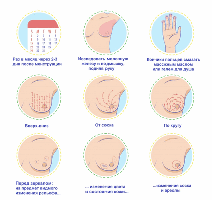 Рак молочной железы: распространенность, патогенез, терапия