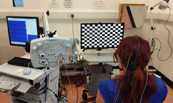 Исследование зрительных вызванных потенциалов