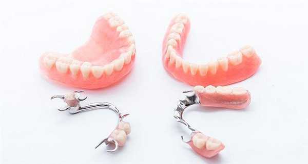 Шатаются зубные протезы