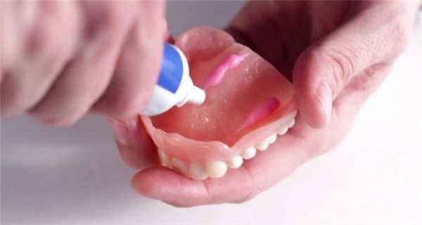 Фиксация гелем когда шатаются зубные протезы