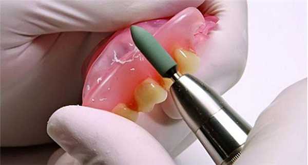 перебазировка зубного протеза