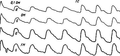 Рис. 47. Положительная проба с нитроглицерином