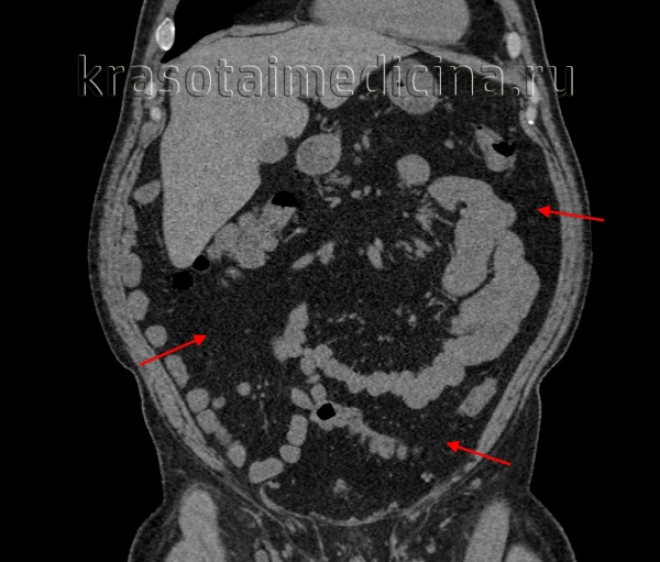 Белодедова Александра Сергеевна, диетолог - Санкт-Петербург