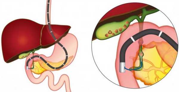 паллиативное лечение5