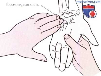 Пальпация запястья и кисти с медиальной (локтевой) стороны