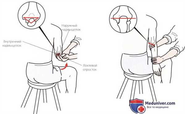 Пальпация локтевого сустава сзади