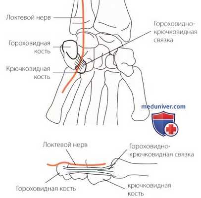 Пальпация запястья и кисти с медиальной (локтевой) стороны