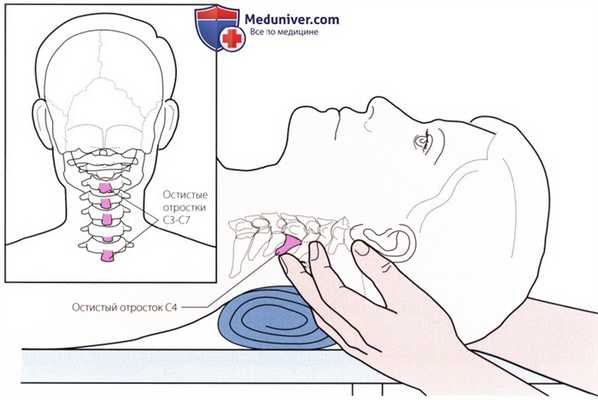 Пальпация костных структур шейного и грудного отделов позвоночника сзади
