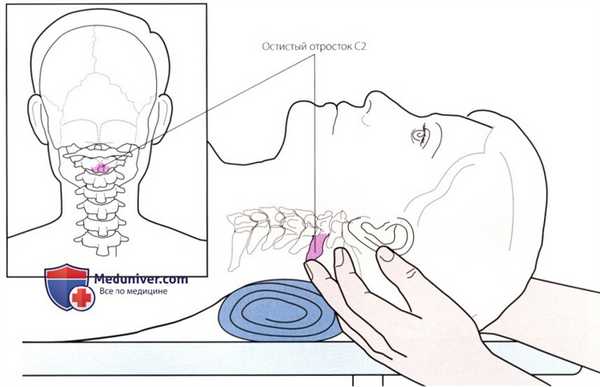 Пальпация костных структур шейного и грудного отделов позвоночника сзади