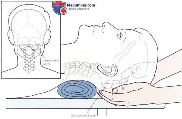 Пальпация костных структур шейного и грудного отделов позвоночника сзади