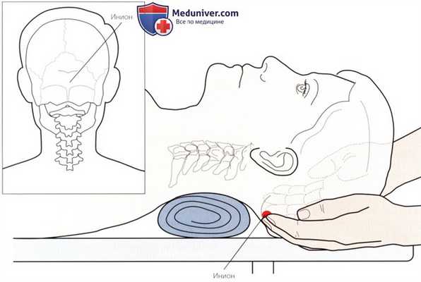Пальпация костных структур шейного и грудного отделов позвоночника сзади