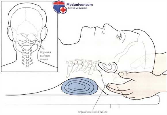 Пальпация костных структур шейного и грудного отделов позвоночника сзади