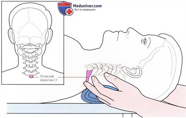 Пальпация костных структур шейного и грудного отделов позвоночника сзади